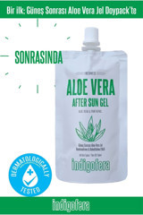 İndigofera Jel Aloe Veralı Nemlendiricili Güneş Sonrası Krem 100 ml