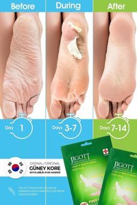 Jigott Ölü Deri-Çatlak Çorap Tipi Ayak Peeling Maskesi