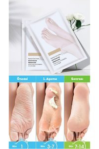 Larimar Ölü Deri-Çatlak Çorap Tipi Ayak Peeling Maskesi