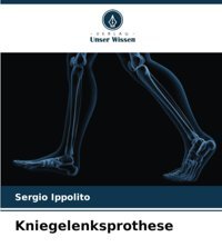 Kniegelenksprothesede Ippolito, Sergio Verlag Unser Wissen