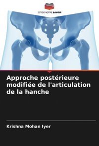 Approche Postrieure Modifie De L'Articulation De La Hanche Iyer, Krishna Mohan Editions Notre Savoir