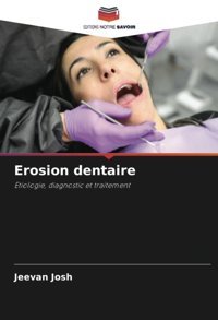 Erosion Dentaire: Etiologie, Diagnostic Et Traitement Josh, Jeevan Editions Notre Savoir