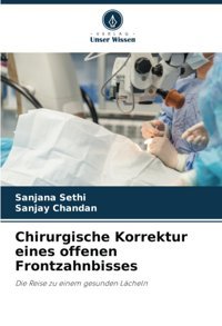 Chirurgische Korrektur Eines Offenen Frontzahnbisses: Die Reise Zu Einem Gesunden Lcheln Sethi, Sanjana Verlag Unser Wissen