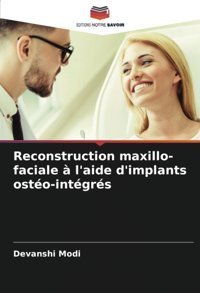 Reconstruction Maxillo-Faciale L'Aide D'İmplants Osto-İntgrs Modi, Devanshi Editions Notre Savoir