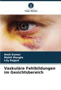 Vaskulre Fehlbildungen İm Gesichtsbereich: De Kumar, Amıt Verlag Unser Wissen