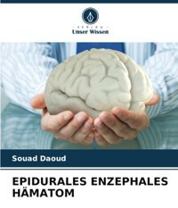 Epıdurales Enzephales Hmatom Daoud, Souad Verlag Unser Wissen