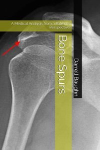 Bone Spurs: A Medical Analysis From A Patients Perspective Baughn, Darrell Independently Publıshed