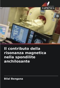 Il Contributo Della Risonanza Magnetica Nella Spondilite Anchilosante Bengana, Bilal Edizioni Sapienza