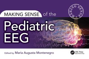 Making Sense Of The Pediatric Eeg Crc Press Inc