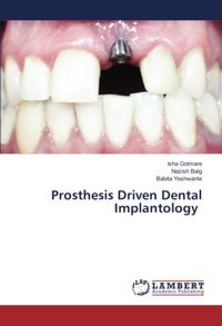 Prosthesis Driven Dental Implantology Gotmare, Isha Lap Lambert Academic Publishing
