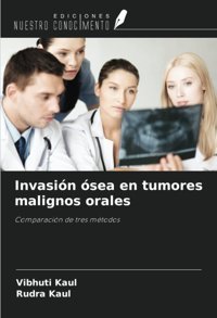 Invasin Sea En Tumores Malignos Orales: Comparacin De Tres Mtodos Kaul, Vibhuti Ediciones Nuestro Conocimiento