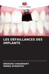 Les Dfaıllances Des Implants Chaudhary, Deeksha Editions Notre Savoir