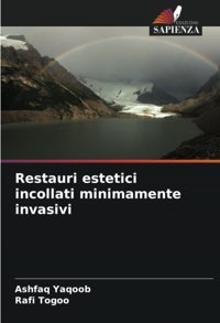 Restauri Estetici İncollati Minimamente İnvasivi: De Yaqoob, Ashfaq Edizioni Sapienza