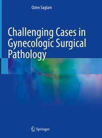 Challenging Cases İn Gynecologic Surgical Pathology Saglam, Ozlen Springer