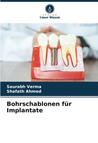 Bohrschablonen Für Implantate Verma, Saurabh Verlag Unser Wissen
