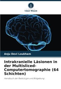 Intrakranielle Lsionen İn Der Multisliced-Computertomographie (64 Schichten): Handbuch Der Radiologie Und Bildgebung Loukham, Anju Devi Verlag Unser Wissen