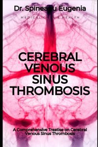 A Comprehensive Treatise On Cerebral Venous Sinus Thrombosis Eugenia, Dr. Spineanu Independently Publıshed