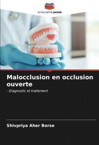 Malocclusion En Occlusion Ouverte: Diagnostic Et Traitement Aher Borse, Shivpriya Editions Notre Savoir