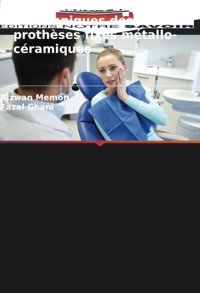 Complications Biologiques Et Techniques Des Prothses Fixes Mtallo-Cramiques Memon, Rizwan Editions Notre Savoir