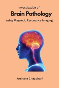 Investigation Of Brain Pathology Using Magnetic Resonance Imaging Chaudhari, Archana Independent Author