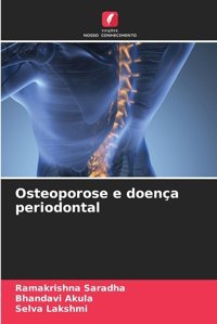 Osteoporose E Doença Periodontal (Portuguese Edition) Saradha, Ramakrishna Edicoes Nosso Conhecimento