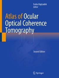 Atlas Of Ocular Optical Coherence Tomography Springer