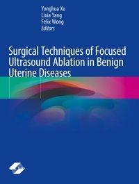 Surgical Techniques Of Focused Ultrasound Ablation İn Benign Uterine Diseases Springer