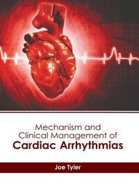 Mechanism And Clinical Management Of Cardiac Arrhythmias Hayle Medical