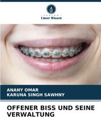 Offener Bıss Und Seıne Verwaltung: De Omar, Anany Verlag Unser Wissen