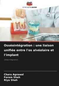 Ossointgration : Une Liaison Unifie Entre L'Os Alvolaire Et L'İmplant: Ostointgration Agrawal, Charu Editions Notre Savoir