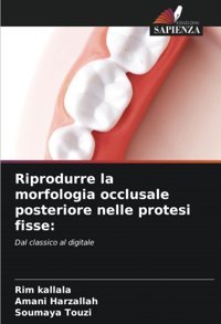 Riprodurre La Morfologia Occlusale Posteriore Nelle Protesi Fisse:: Dal Classico Al Digitale Kallala, Rim Edizioni Sapienza