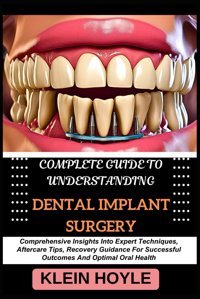 Complete Guıde To Understandıng Dental Implant Surgery: Comprehensive Insights Into Expert Techniques, Aftercare Tips, Recovery Guidance For Successful Outcomes And Optimal Oral Health Hoyle, Kleın Independently Publıshed