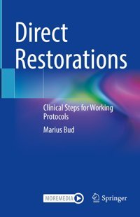 Direct Restorations: Clinical Steps For Working Protocols Bud, Marius Springer