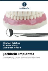 Jochbein-Implantat: Eine Hoffnung Für Den Resorbierten Kieferkamm Krishna, Chetan Verlag Unser Wissen
