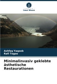 Minimalinvasiv Geklebte Sthetische Restaurationen: De Yaqoob, Ashfaq Verlag Unser Wissen