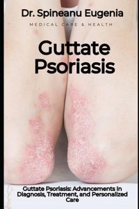 Guttate Psoriasis: Advancements İn Diagnosis, Treatment, And Personalized Care Eugenia, Dr. Spineanu Independently Publıshed