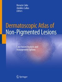 Dermatoscopic Atlas Of Non-Pigmented Lesions: Case-Based Analysis And Management Options Springer