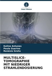 Multıslıce-Tomographıe Mıt Nıedrıger Strahlendosıerung: De Antunes, Kaline Verlag Unser Wissen