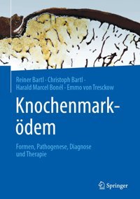 Knochenmarködem: Fortschritte İn Diagnostik Und Therapie Bartl, Reiner Springer