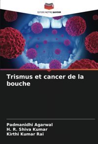 Trismus Et Cancer De La Bouche Agarwal, Padmanidhi Editions Notre Savoir