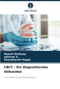 Cbct Ein Diagnostisches Hilfsmittel: In Der Parodontologie & Implantologie Kashyap, Rajesh Verlag Unser Wissen