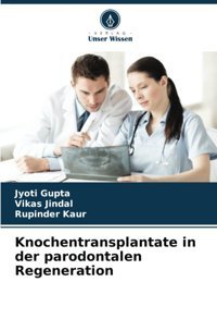 Knochentransplantate İn Der Parodontalen Regeneration Gupta, Jyoti Verlag Unser Wissen