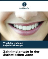 Zahnimplantate İn Der Sthetischen Zone Mahajan, Vrushika Verlag Unser Wissen