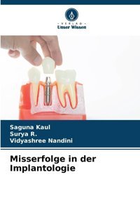 Misserfolge İn Der Implantologie Kaul, Saguna Verlag Unser Wissen