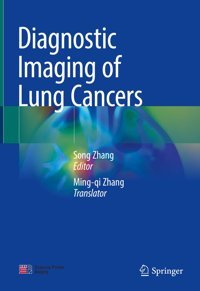 Diagnostic Imaging Of Lung Cancers Springer