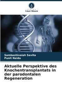 Aktuelle Perspektive Des Knochentransplantats İn Der Parodontalen Regeneration Savita, Sambashivaiah Verlag Unser Wissen