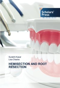 Hemısectıon And Root Resectıon: De Kasar, Surabhi Scholars' Press