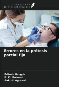 Errores En La Prtesis Parcial Fija Gangde, Pritesh Ediciones Nuestro Conocimiento