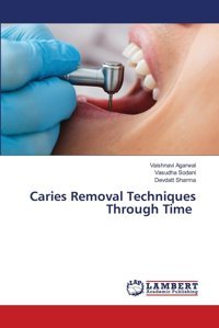 Caries Removal Techniques Through Time: De Agarwal, Vaishnavi Lap Lambert Academic Publishing