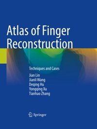 Atlas Of Finger Reconstruction: Techniques And Cases Lin, Jian Springer